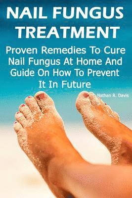 Nail Fungus Treatment: Proven Remedies To Cure Nail Fungus At Home And Guide On How To Prevent It In Future: (How to Cure Toenail Fungus) 1