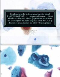 bokomslag EVALUACION DE LA INMUNOTINCION DUAL P16INK4a/Ki67 EN COMPARACION CON EL TEST DEL VIRUS DEL PAPILOMA HUMANO EN CITOLOGIAS DE BASE LIQUIDA CON ASCUS Y L