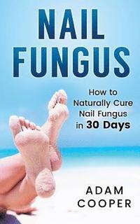 bokomslag Nail Fungus: How to Naturally Cure Nail Fungus in 30 Days: Natural remedies, homeopathy for toenail fungus