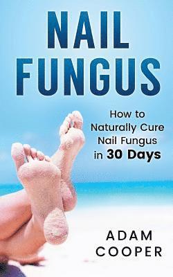 Nail Fungus: How to Naturally Cure Nail Fungus in 30 Days: Natural remedies, homeopathy for toenail fungus 1
