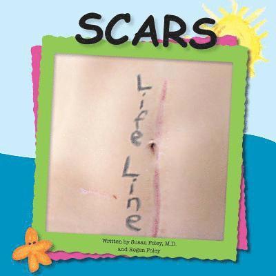 Regen Foley, Susan Foley - Scars, Häftad