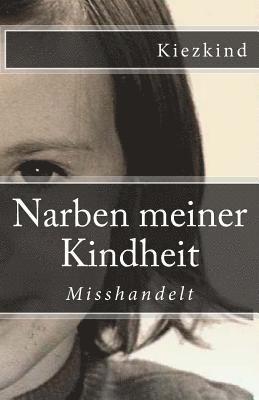 Narben meiner Kindheit 1