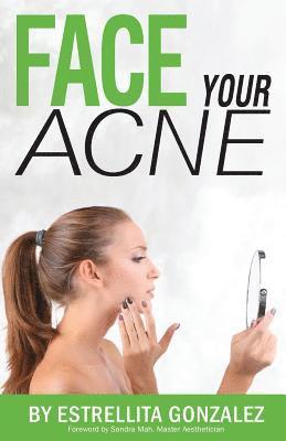 bokomslag Face Your Acne