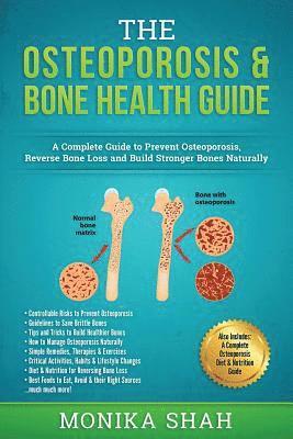 bokomslag Osteoporosis