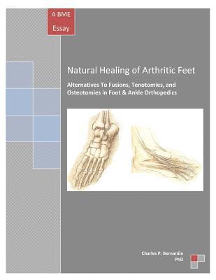 bokomslag Natural Healing of Arthritic Feet: Alternatives To Fusions, Tenotomies, and Osteotomies in Foot & Ankle Orthopedics