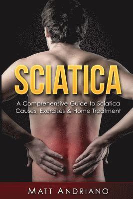 Sciatica: A Comprehensive Guide to Sciatica Causes, Exercises & Home Treatment 1