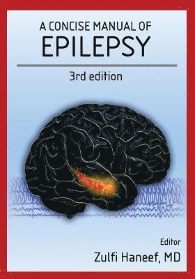 A concise manual of epilepsy: 3rd edition 1