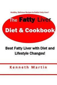 bokomslag The Fatty Liver Diet & Cookbook: Beat Fatty Liver with Diet & Lifestyle Changes