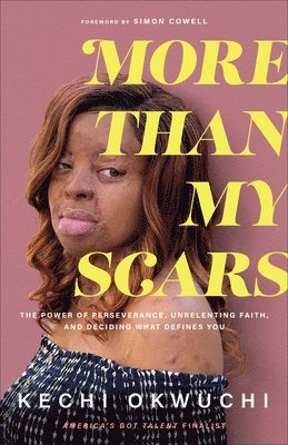 More Than My Scars 1