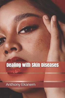 Dealing with Skin Diseases 1