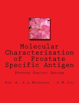 Molecular Characterization of Prostate Specific Antigen: Prostate Specific Antigen 1