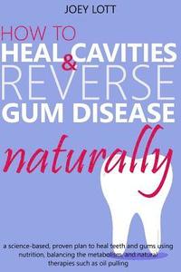 bokomslag How to Heal Cavities and Reverse Gum Disease Naturally: a science-based, proven plan to heal teeth and gums using nutrition, balancing the metabolism,