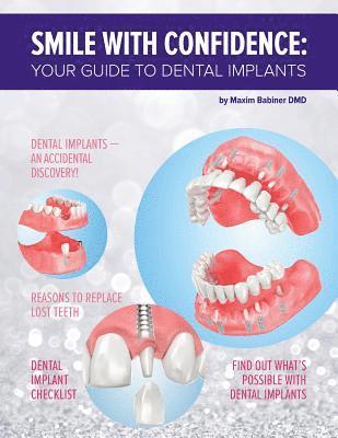 bokomslag Smile with confidence: Your guide to dental implants