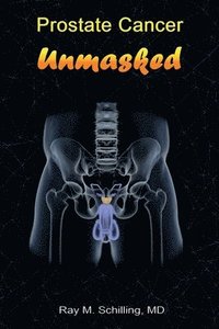 bokomslag Prostate Cancer Unmasked