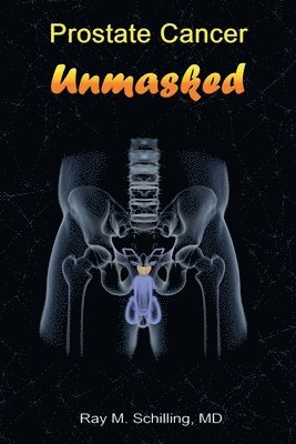 Prostate Cancer Unmasked 1