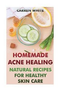 bokomslag Homemade Acne Healing: Natural Recipes for Healthy Skin Care: (Essential Oils, Aromatherapy)