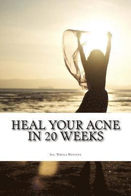 bokomslag Heal your acne in 20 weeks: Everyday skin care plan