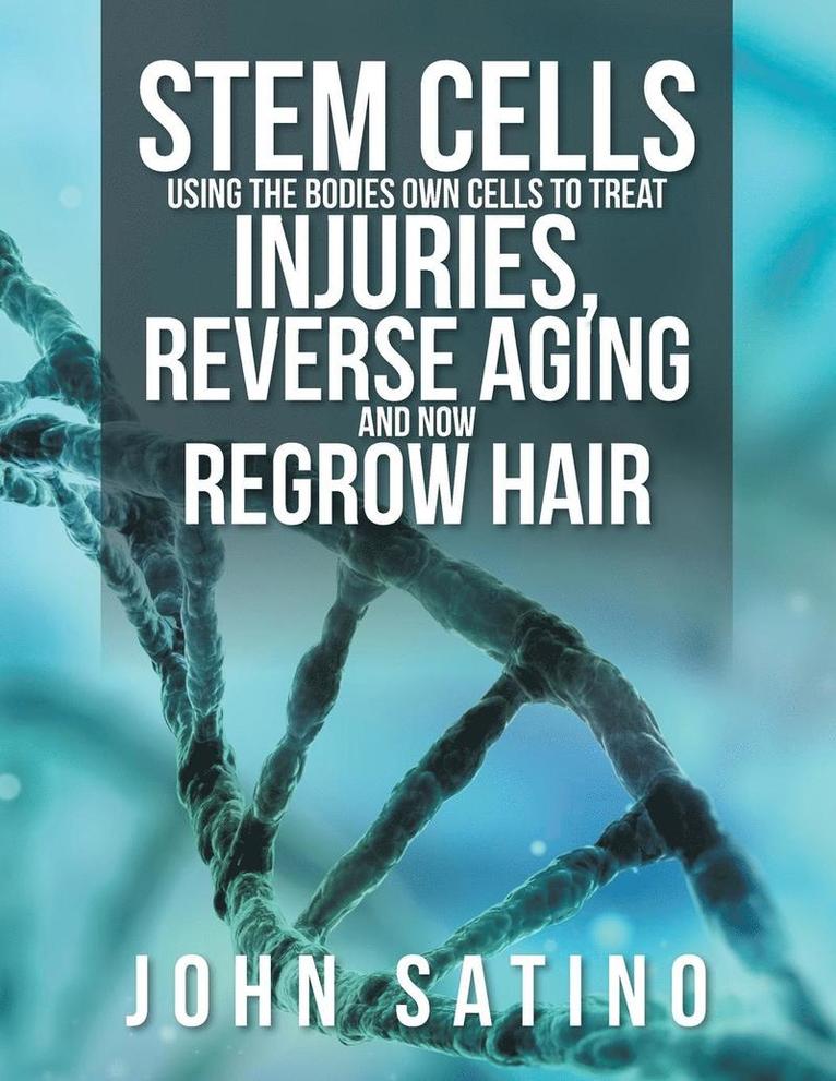Stem Cells Using the Bodies Own Cells to Treat Injuries, Reverse Aging and Now Regrow Hair 1