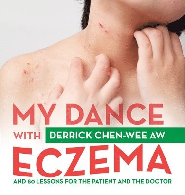 bokomslag My Dance with Eczema