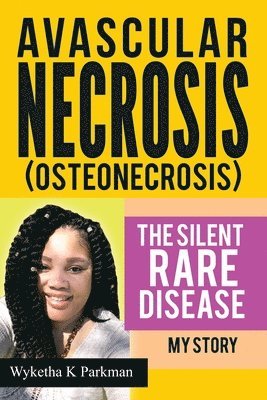 Avascular Necrosis (Osteonecrosis) The Silent Rare Disease 1