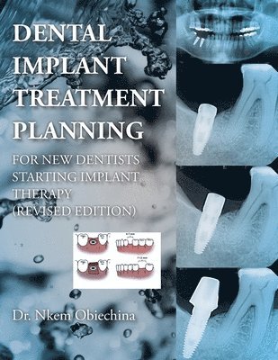 Dental Implant Treatment Planning for New Dentists Starting Implant Therapy 1