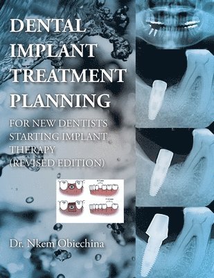 Nkem Obiechina, Dr. Nkem Obiechina - Dental Implant Treatment Planning for New Dentists Starting Implant Therapy, Häftad