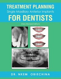 bokomslag Treatment Planning Single Maxillary Anterior Implants for Dentists
