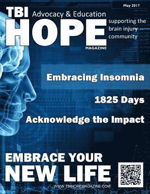 TBI HOPE Magazine - May 2017 1