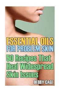 bokomslag Essential Oils For Problem Skin: 50 Recipes That Heal Widespread Skin Issues