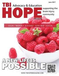 bokomslag TBI HOPE Magazine - June 2017