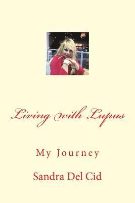 bokomslag Living with Lupus