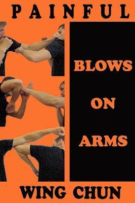 Painful blows on arms 1