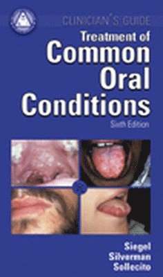 Michael Siegal, Sol Silverman, Thomas Sollecito - Treatment Common Oral Conditions, Häftad