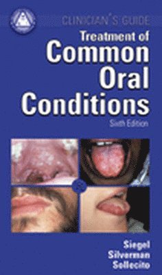 Treatment Common Oral Conditions 1