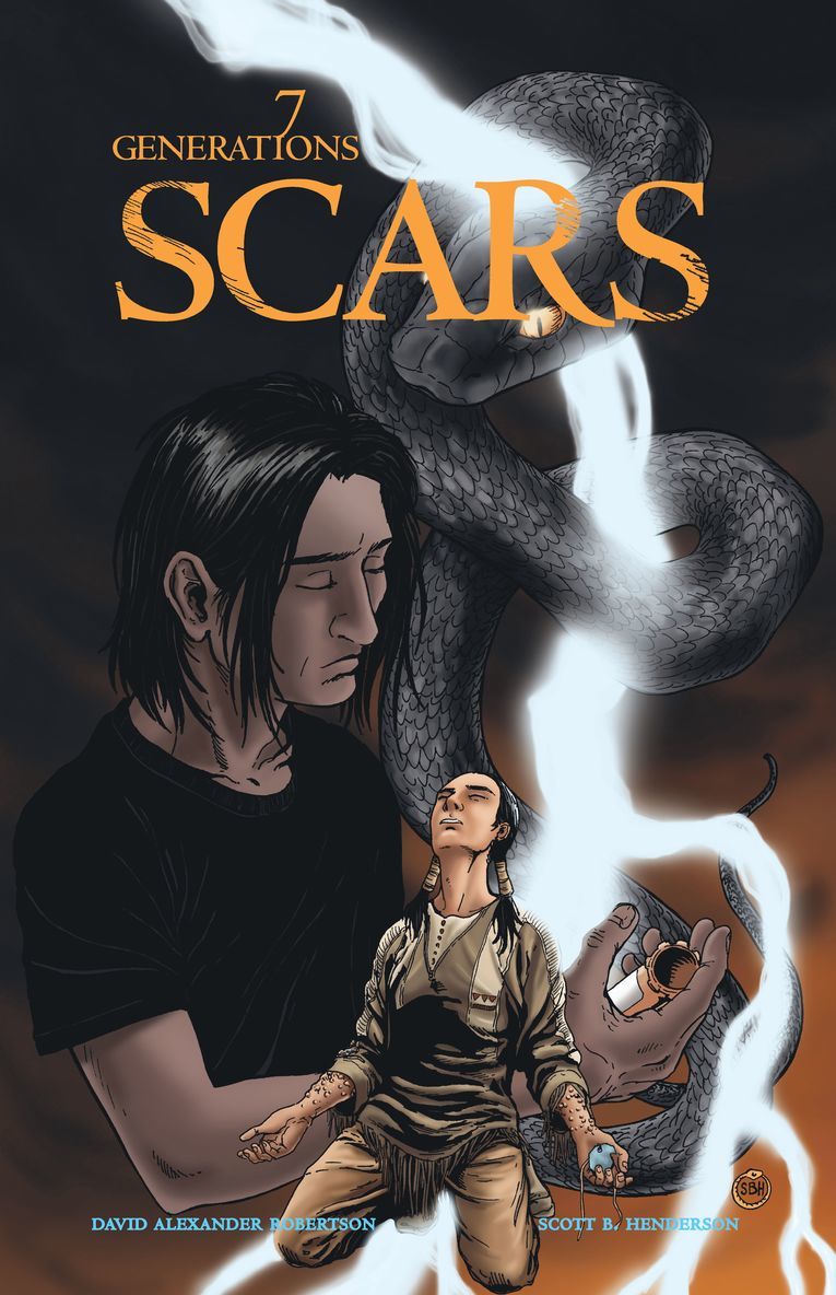 Scars