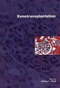 bokomslag Xenotransplantation