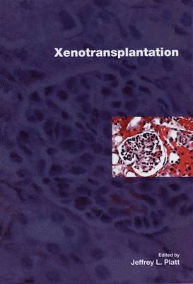 Xenotransplantation 1