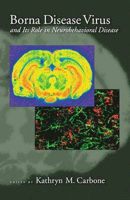 bokomslag Borna Disease Virus and its Role in Neurobehavioral Diseases