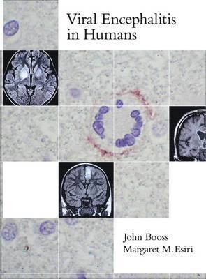 bokomslag Viral Encephalitis in Humans