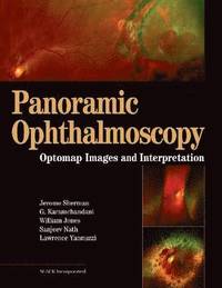 bokomslag Panoramic Ophthalmoscopy