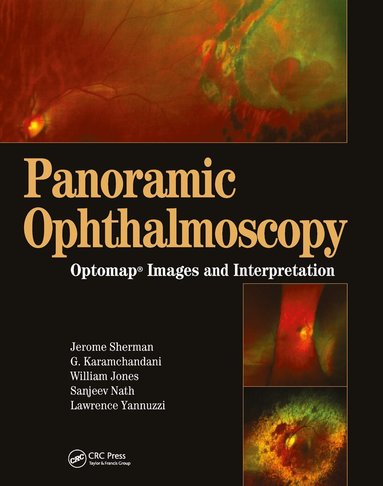 bokomslag Panoramic Ophthalmoscopy