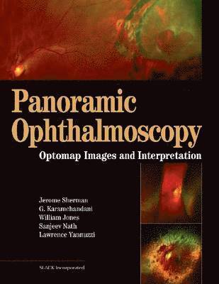 Panoramic Ophthalmoscopy 1
