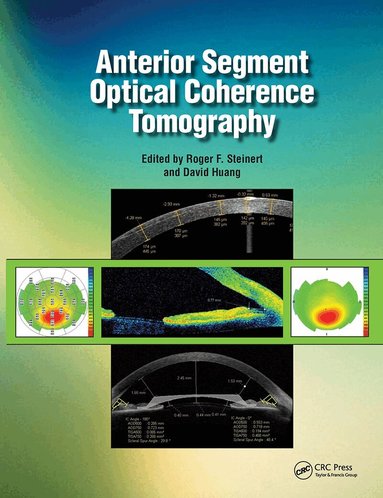 Roger Steinert, David Huang - Anterior Segment Optical Coherence Tomography, Inbunden