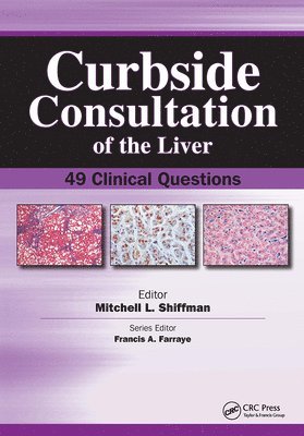 Curbside Consultation of the Liver 1