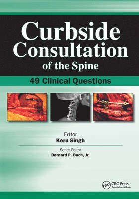 bokomslag Curbside Consultation of the Spine