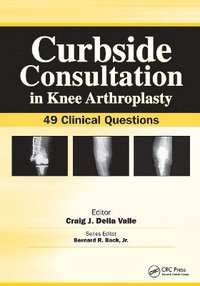 bokomslag Curbside Consultation in Knee Arthroplasty