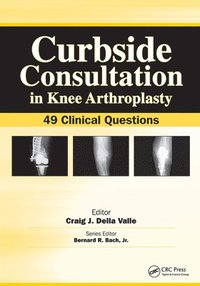 bokomslag Curbside Consultation in Knee Arthroplasty