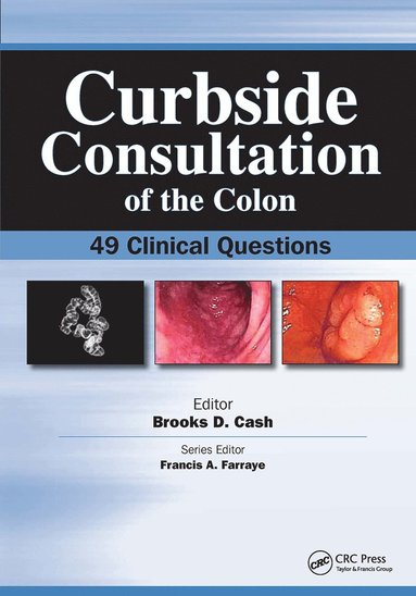 bokomslag Curbside Consultation of the Colon