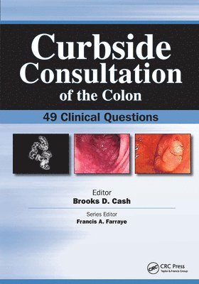 Curbside Consultation of the Colon