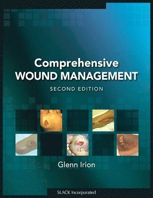 Comprehensive Wound Management 1